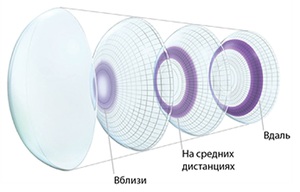 Для чего нужны мультифокальные линзы?